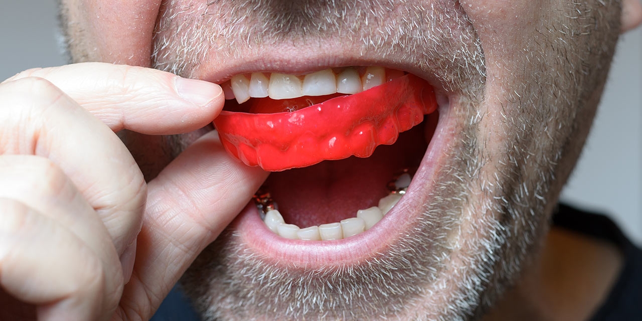Wear your mouth guard!