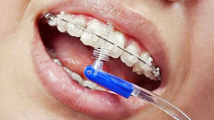 Tips for Proper Oral Hygiene