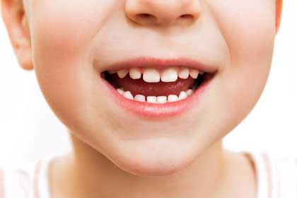 Kids teeth